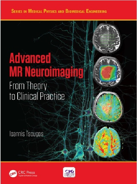 Advanced MR Neuroimaging from Theory to Clinical Practice PDF