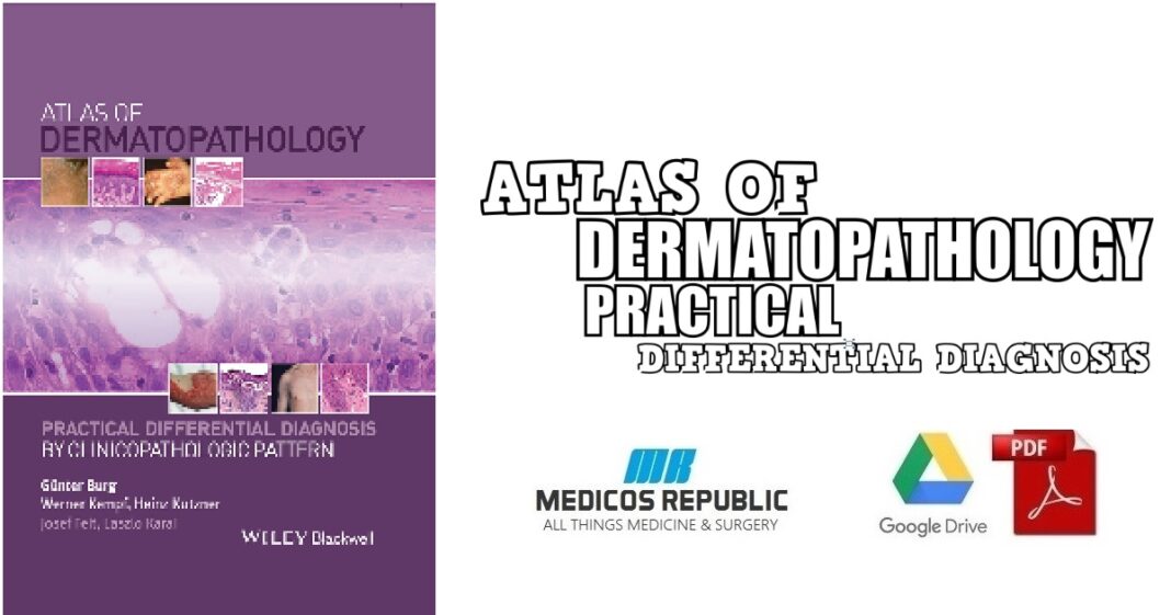 Atlas of Dermatopathology Practical Differential Diagnosis PDF