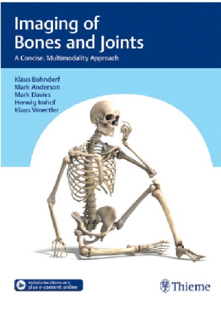 Bones And Joints A Concise Multimodality Approach PDF