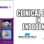 Clinical Cases in Endodontics PDF