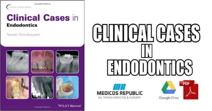 Clinical Cases in Endodontics PDF