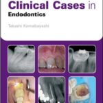 Clinical Cases in Endodontics PDF