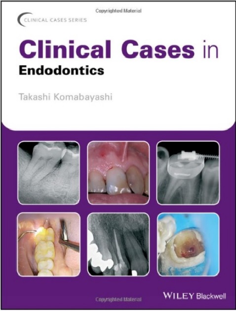 Clinical Cases in Endodontics PDF