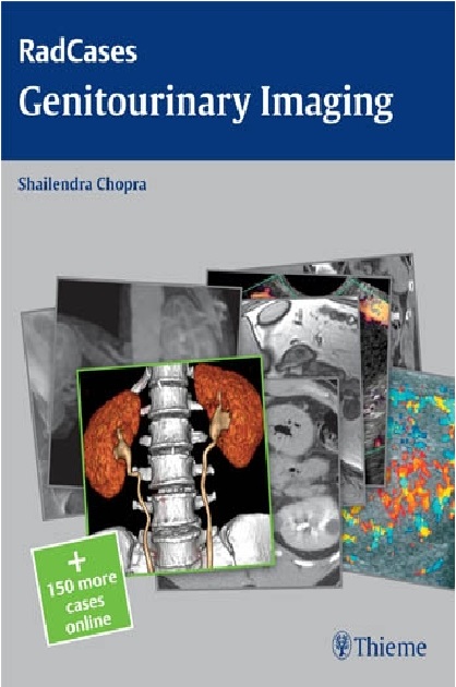 Genitourinary Imaging PDF