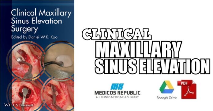 clinical maxillary sinus elevation surgery PDF