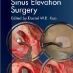 clinical maxillary sinus elevation surgery