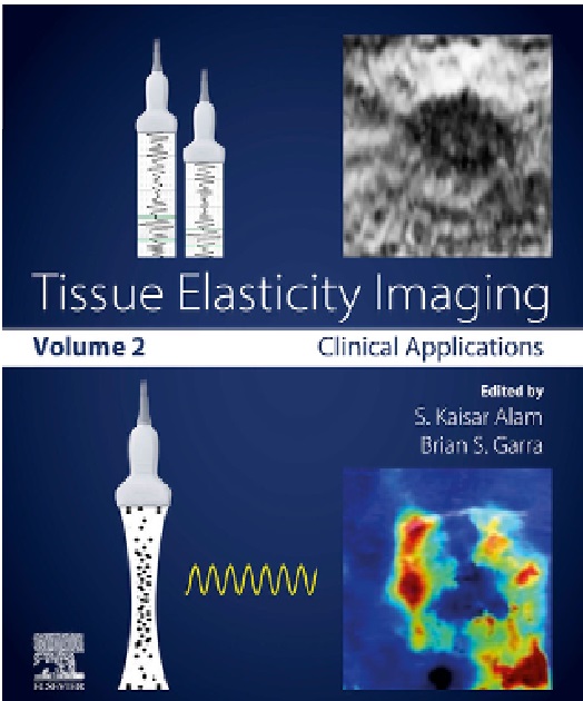 tissue elasticity imaging vol.1 PDF