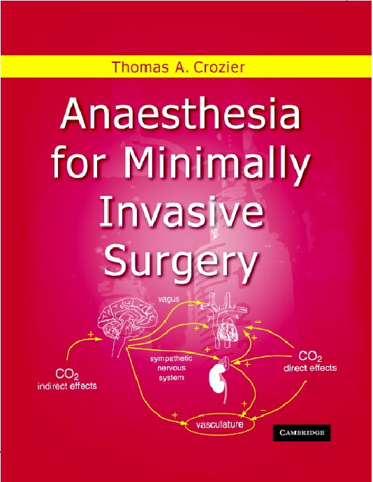 Anesthesia for minimally invasive surgery PDF 