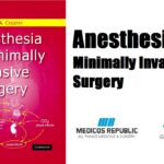 Anesthesia for minimally invasive surgery PDF