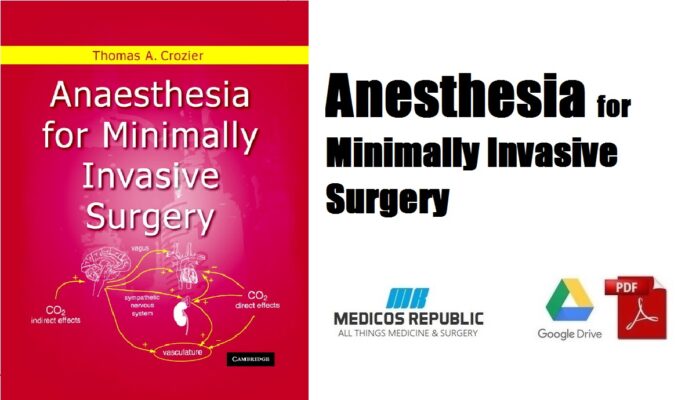 Anesthesia for minimally invasive surgery PDF