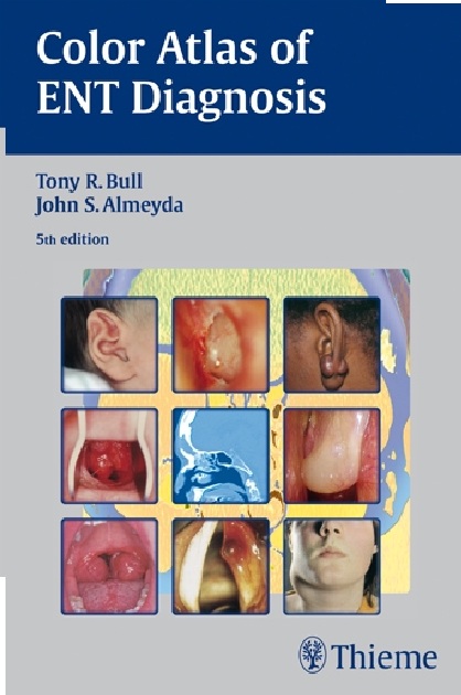 Color Atlas of ENT Diagnosis PDF