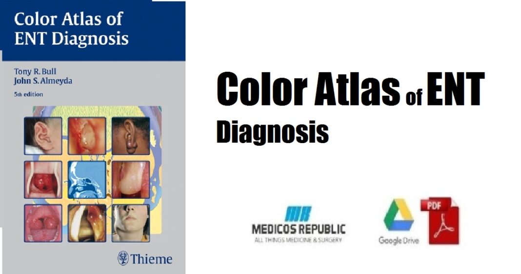 Color Atlas of ENT Diagnosis PDF Free Download