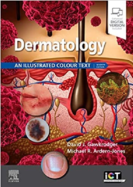 Dermatology an illustrated color text PDF
