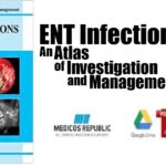 ENT Infections An Atlas of Investigation and Management PDF