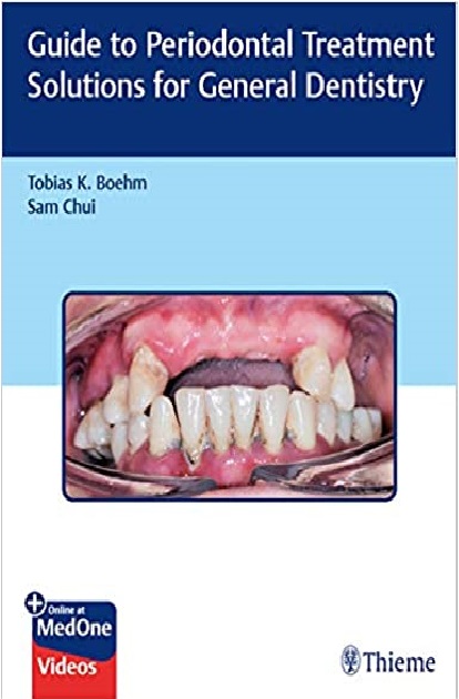 Guide to Periodontal Treatment Solutions for General Dentistry 1st Edition PDF