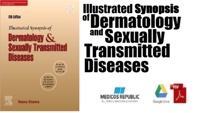 Illustrated Synopsis of Dermatology and Sexually Transmitted Diseases PDF