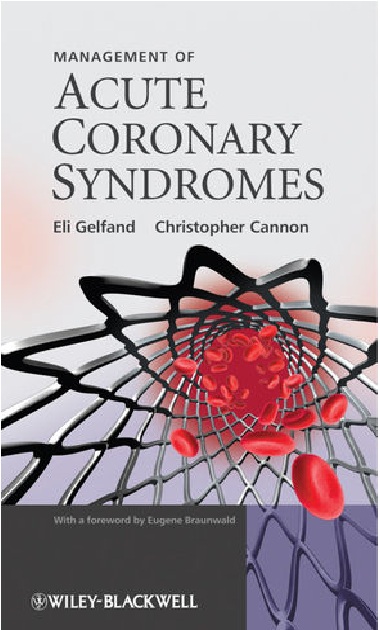Management of Acute Coronary Syndromes PDF 