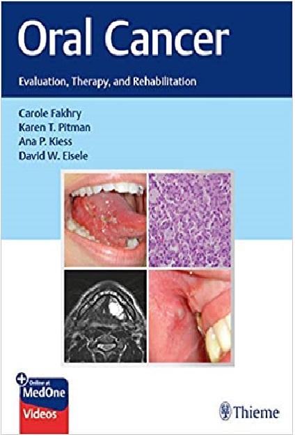 Oral Cancer: Evaluation, Therapy, and Rehabilitation 1st Edition PDF