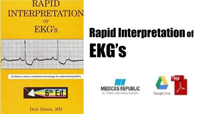 Rapid Interpretation of EKG’s PDF