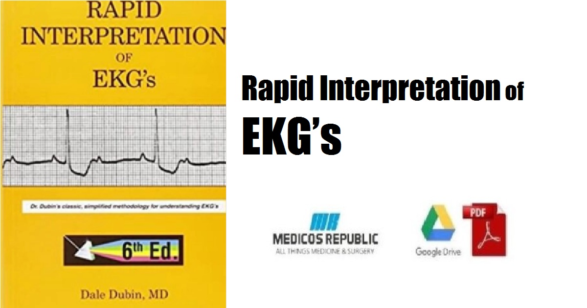 Rapid Interpretation of EKG’s PDF