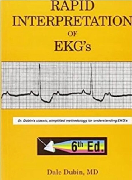 Rapid Interpretation of EKG’s PDF