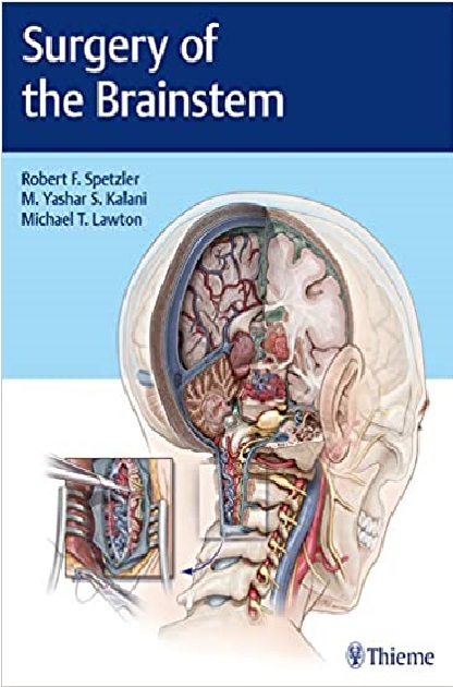 Surgery of the Brainstem 1st Edition PDF