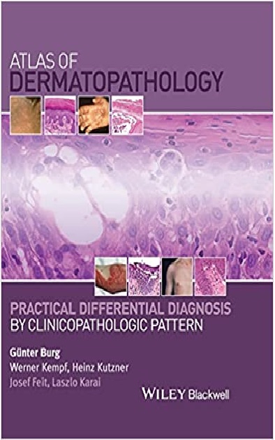 Atlas of Dermatopathology: Practical Differential Diagnosis by Clinicopathologic Pattern 1st Edition PDF