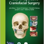 Atlas-of-Operative-Craniofacial-Surgery