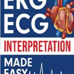 EKG ECG Interpretation Made Easy PDF Free Download