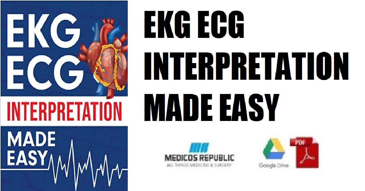 EKG | ECG Interpretation Made Easy PDF