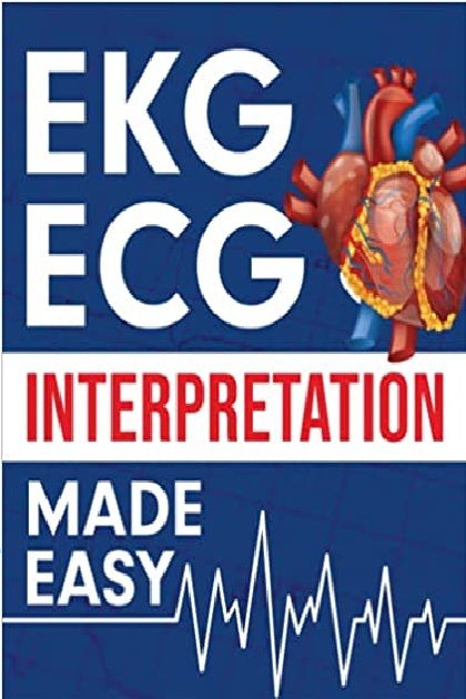 EKG | ECG Interpretation Made Easy PDF