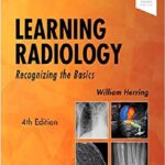 Learning Radiology Recognizing the Basics 4th Edition PDF Free Download