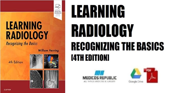 Learning Radiology Recognizing the Basics 4th Edition PDF