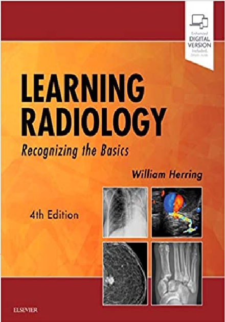 Learning Radiology: Recognizing the Basics 4th Edition PDF