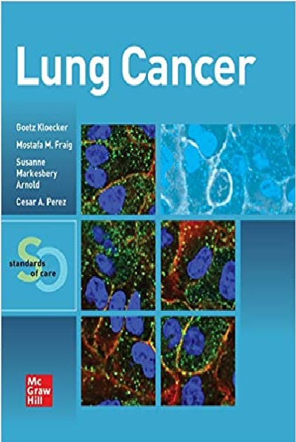 Lung Cancer: Standards of Care 1st Edition PDF