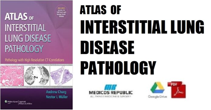 Atlas of Interstitial Lung Disease Pathology PDF