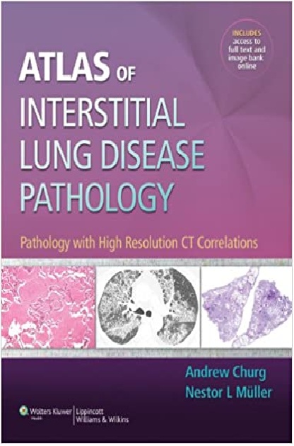 Atlas of Interstitial Lung Disease Pathology PDF