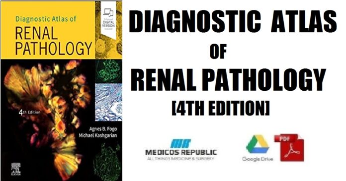 Diagnostic Atlas of Renal Pathology 4th Edition PDF