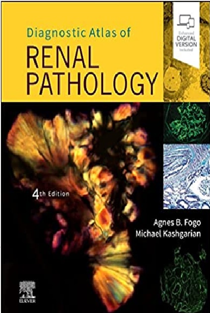 Diagnostic Atlas of Renal Pathology 4th Edition PDF