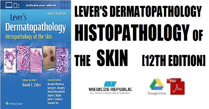 Lever's Dermatopathology Histopathology of the Skin 12th Edition PDF