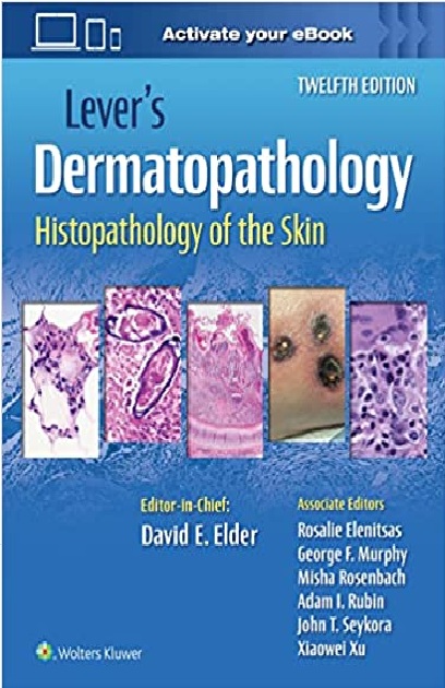 Lever's Dermatopathology: Histopathology of the Skin 12th Edition PDF