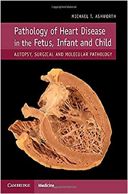 Pathology of Heart Disease in the Fetus, Infant and Child: Autopsy, Surgical and Molecular Pathology 1st Edition PDF