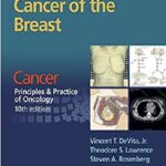 Cancer of the Breast From Cancer Principles & Practice of Oncology, 10th Edition PDF Free Download