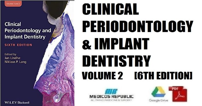 Clinical Periodontology and Implant Dentistry, 2 Volume Set 6th Edition PDF