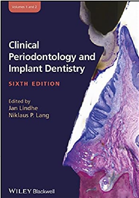 Clinical Periodontology and Implant Dentistry, 2 Volume Set 6th Edition PDF