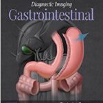 Diagnostic Imaging Gastrointestinal E-Book 3rd Edition PDF Free Download