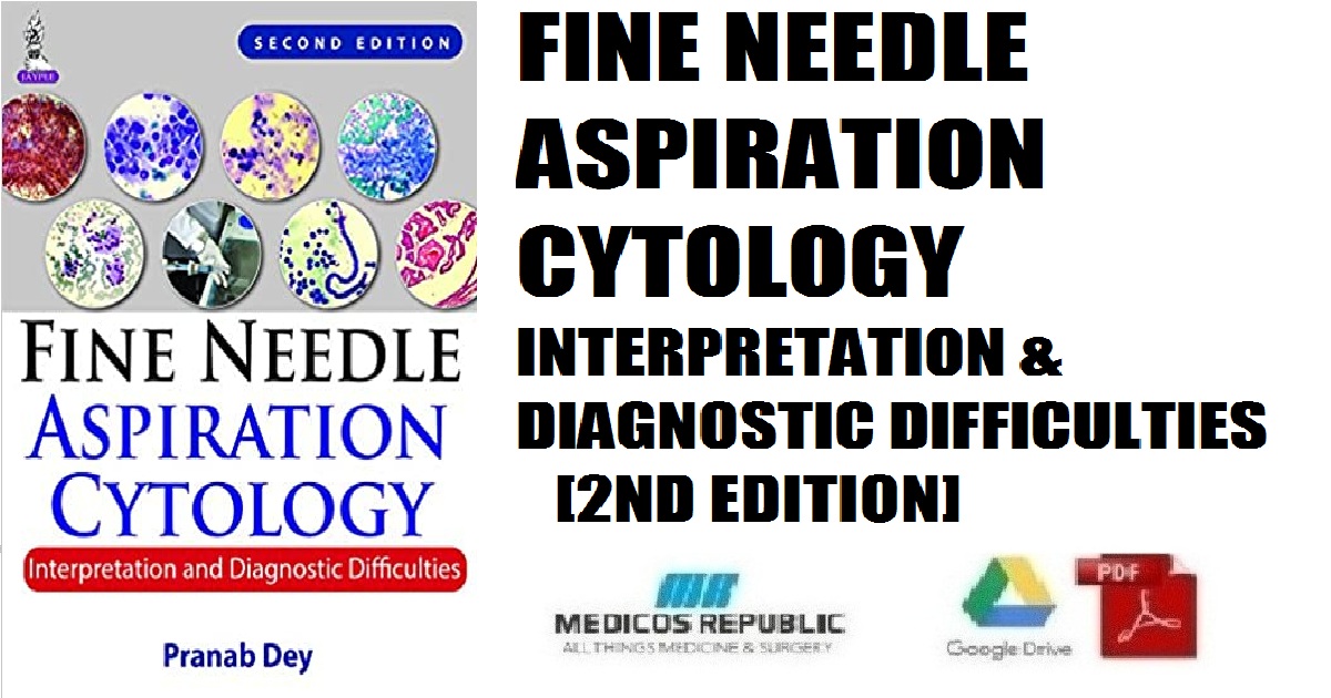 Fine Needle Aspiration Cytology: Interpretation and Diagnostic Difficulties 2nd Edition PDF