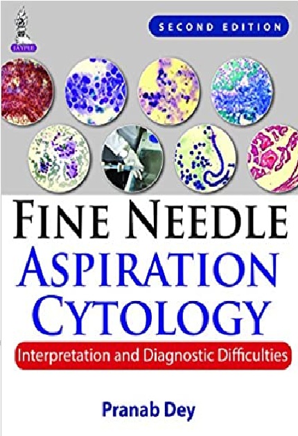 Fine Needle Aspiration Cytology: Interpretation and Diagnostic Difficulties 2nd Edition PDF