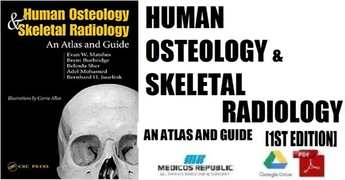 Human Osteology and Skeletal Radiology An Atlas and Guide 1st Edition PDF