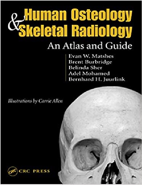 Human Osteology and Skeletal Radiology: An Atlas and Guide 1st Edition PDF